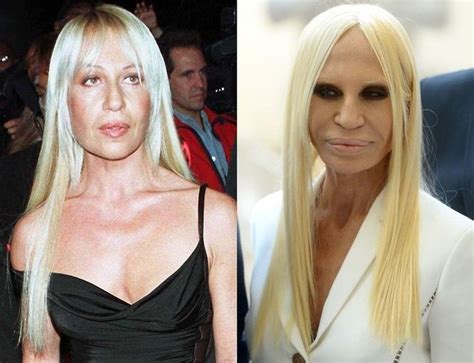 danatela versace|donatella versace before and after.